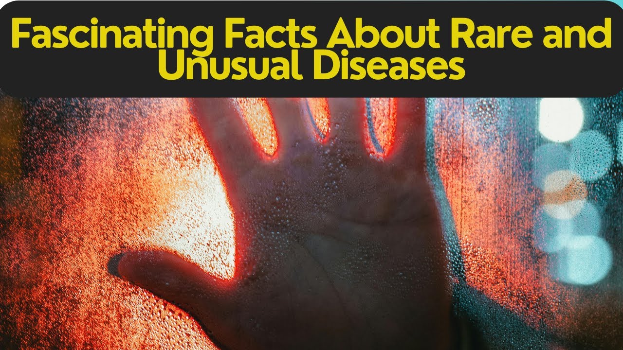 Unraveling Medical Mysteries: 10 Fascinating Facts About Rare and Unusual Diseases