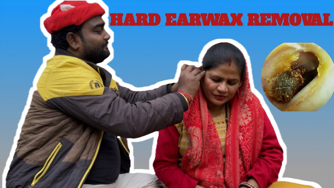 HARD EXTREME 12$ CUTE MOTHER EAR DIRT CLEANING AND OILING PROCESS| EAR CLEANING ASMR | ASMR MAYA 