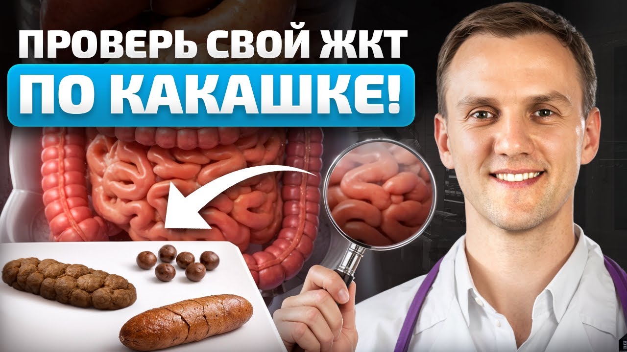 Узнай ЗДОРОВ ли ты по своей КАКАШКЕ! Как БЫСТРО диагностировать БОЛЕЗНЬ по цвету и форме кала?!