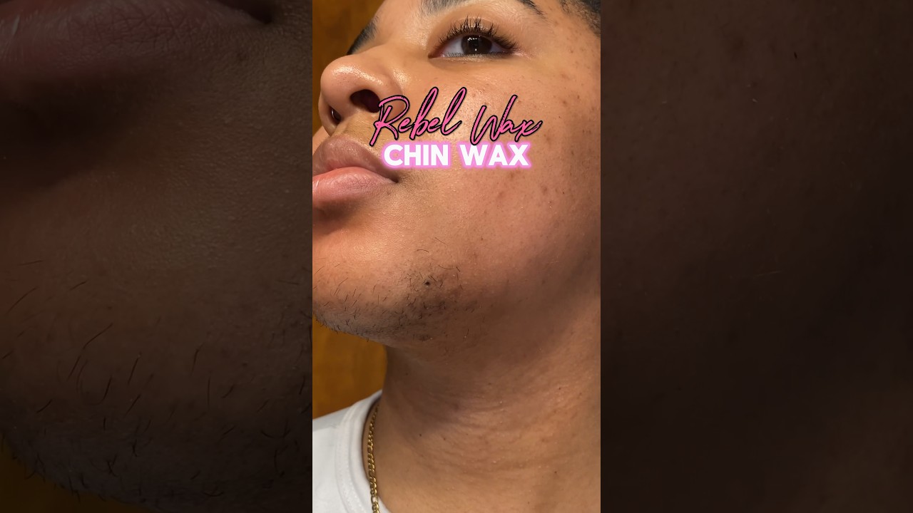 Pcos chin wax #pcos #chinwax