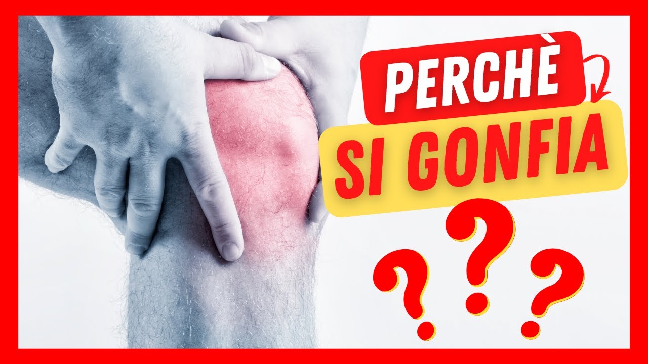 🔴 GINOCCHIO GONFIO? Quali sono le CAUSE e COSA FARE!