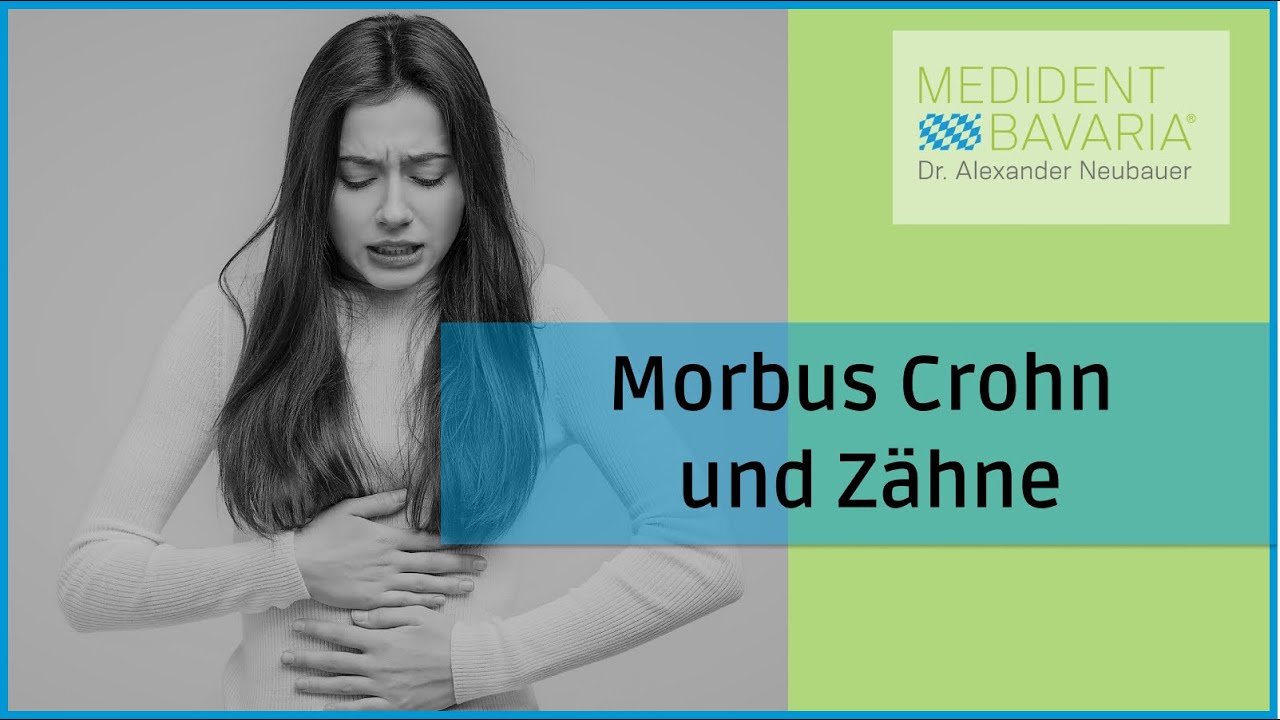 Morbus Crohn und Zähne