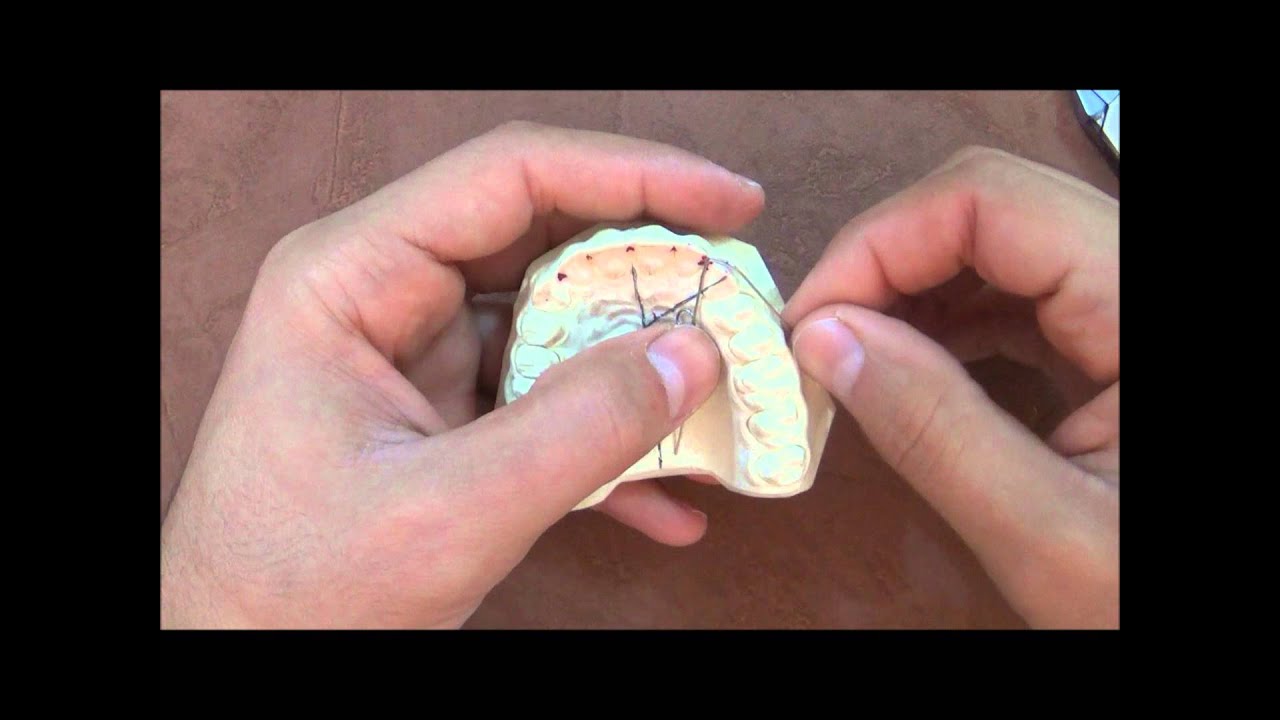 Simple finger spring