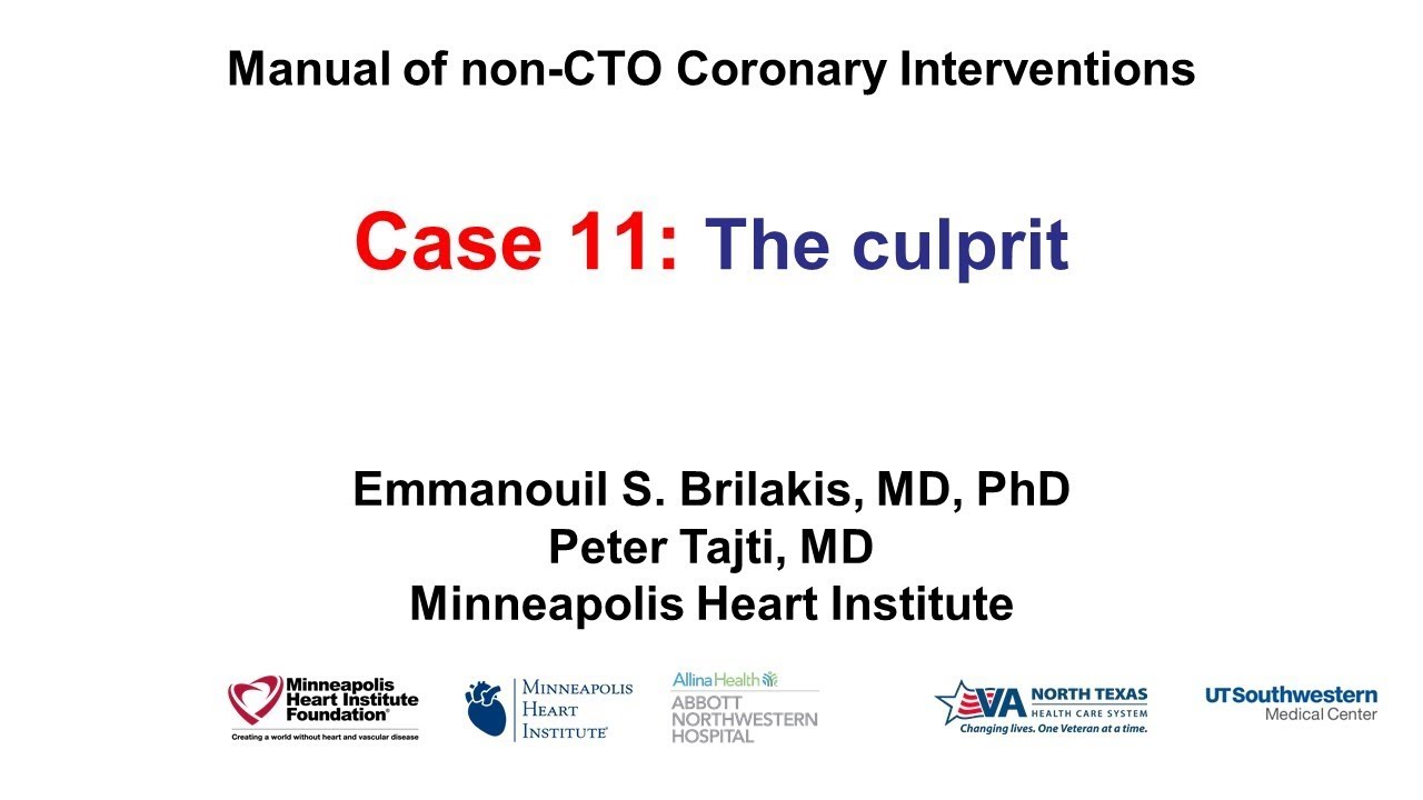 Case 11: PCI Manual - The 