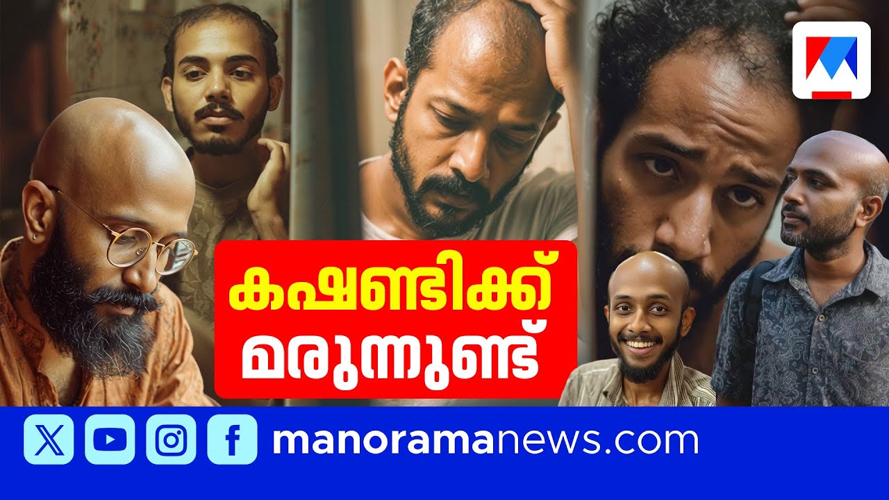 കഷണ്ടിക്ക് ശാശ്വത പരിഹാരം?; മരുന്ന് വിജയകരമെന്ന് ശാസ്ത്രജ്ഞർ | Baldness Cure | Hair Loss Treatment
