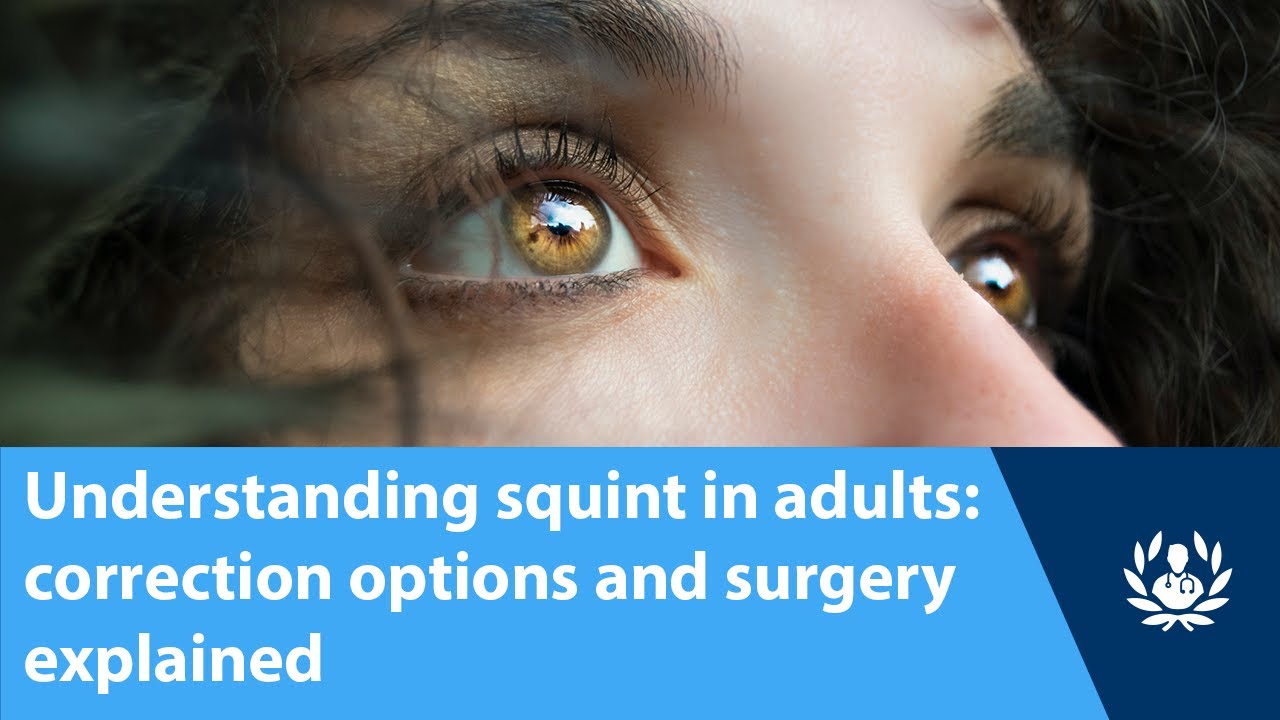 Understanding squint in adults: correction options and surgery explained