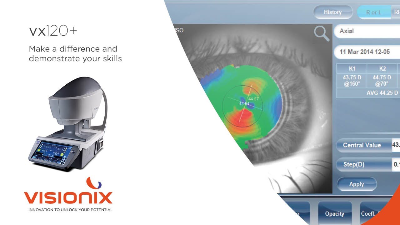 Visionix&reg; VX120+  - EN
