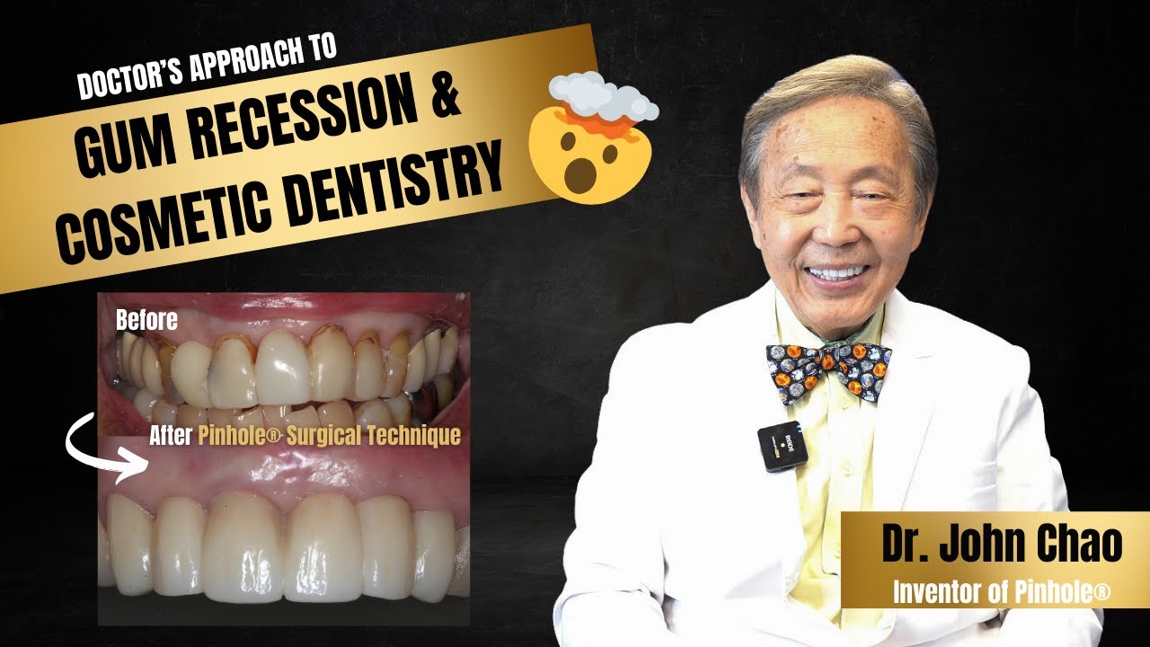 Doctor's Approach to Gum Recession & Cosmetic Dentistry 💥🦷 #gumrecession #pinholegumrejuvenation