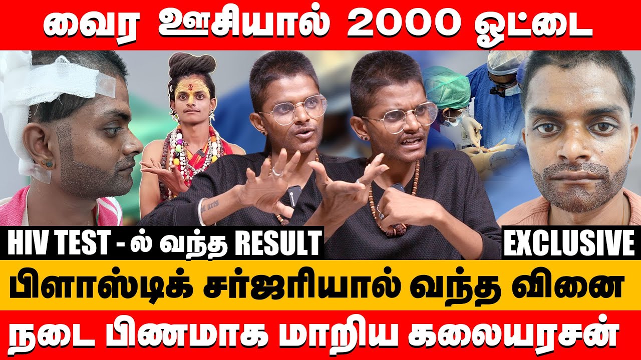 பிளாஸ்டிக் சர்ஜரியால் வந்த வினை நடை பிணமாக மாறிய கலையரசன் | agori kalaiyarasan Exclusive interview