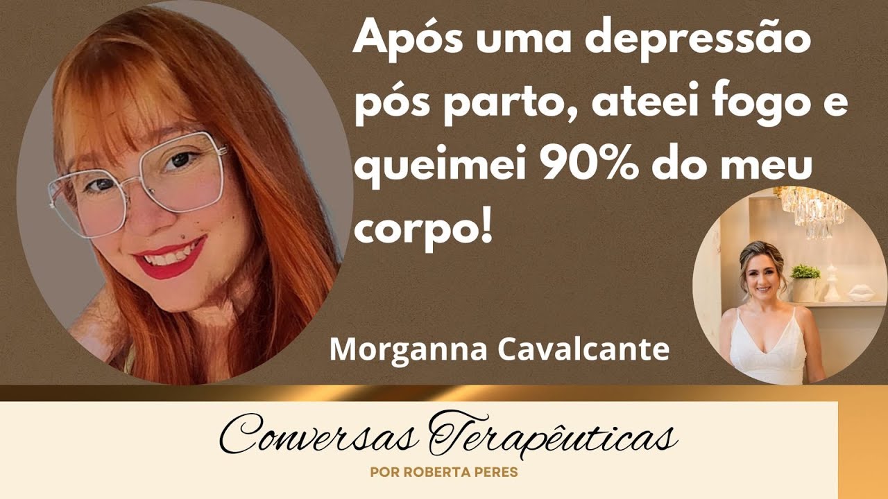 Após uma depressão pós parto, ateei fogo e queimei 90% do meu corpo!