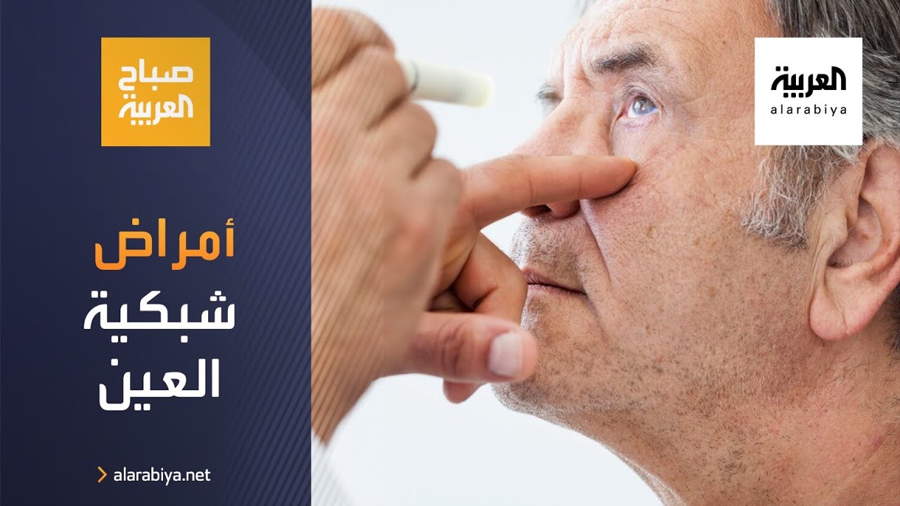 صباح العربية | كيف تتعامل مع أمراض شبكية العين؟
