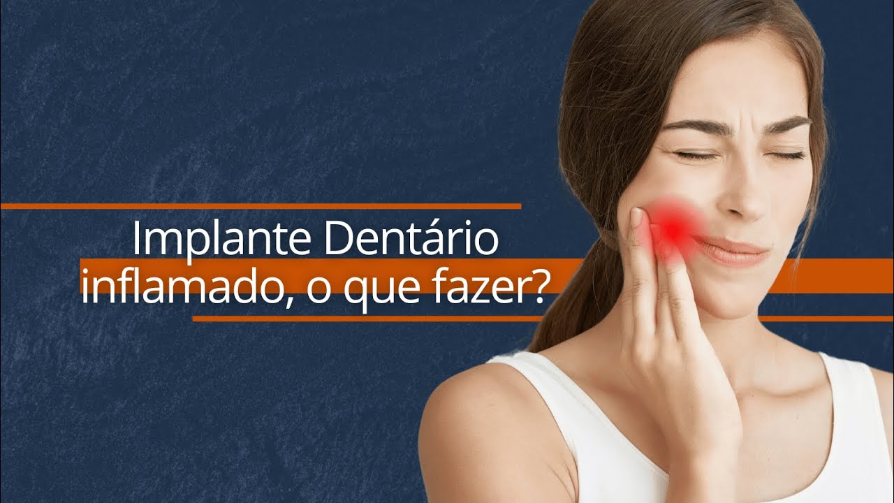 🦷 Implante Dentário INFLAMADO E AGORA? Dicas de 2024 com a Dra. Andressa Mezzomo 😷💡