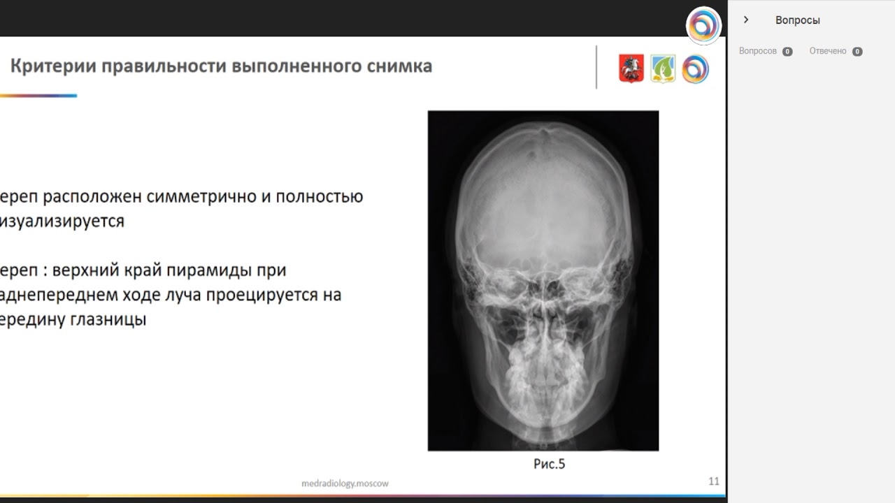 Технологии проведения рентгенологических исследований головы