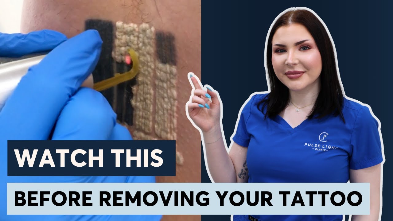 Top Clinic Practitioner Answers Questions About Tattoo Removal
