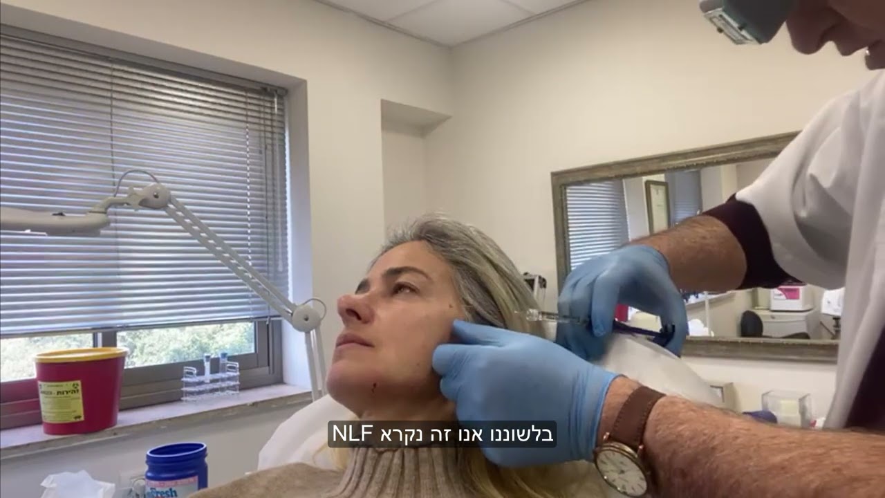 עיצוב קו לסת ומילוי פנים באמצעות הזרקת חומצה היאלורונית