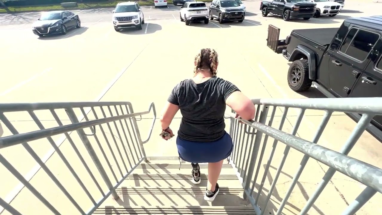 Kat, Above Knee Amputee, Double Wall Prosthetic Socket Leg
