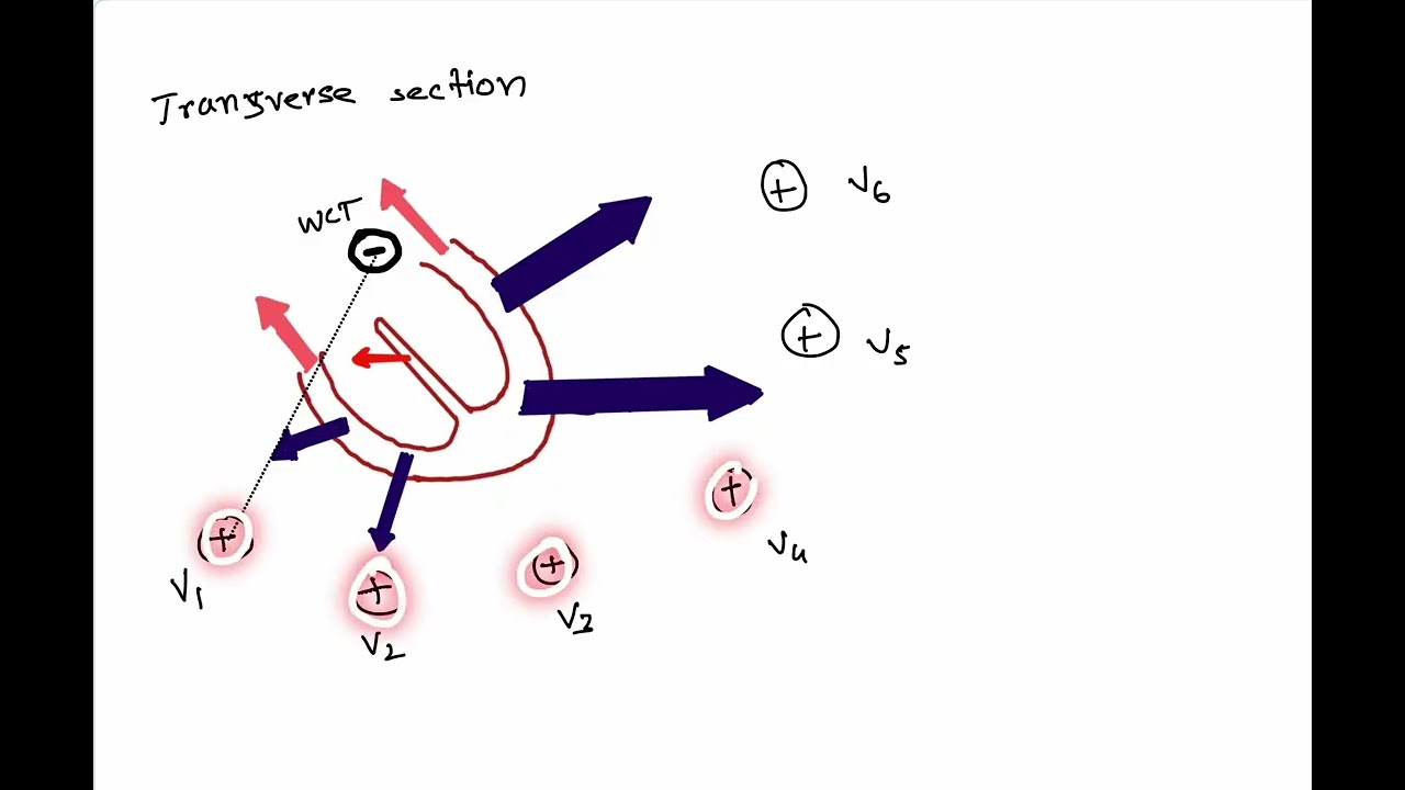 ECG in Bangla: Part 5 (The Chest Leads)