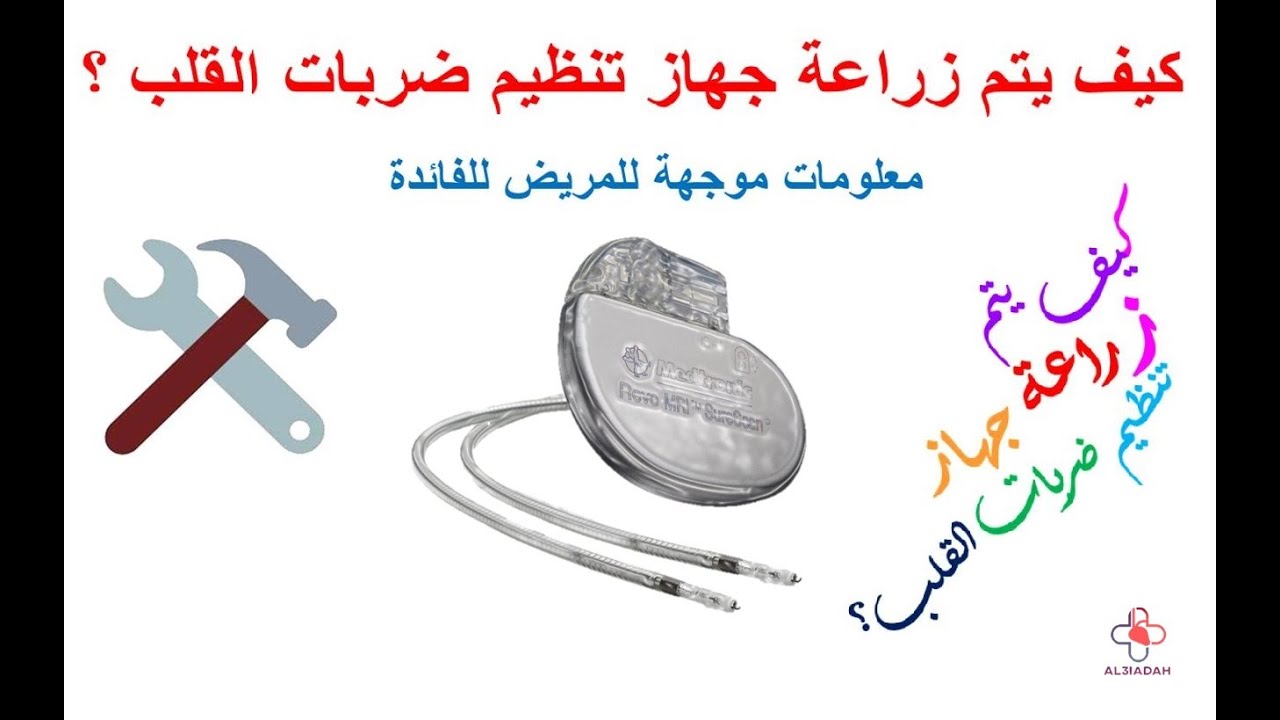 كيف يتم زراعة جهاز تنظيم ضربات القلب ؟ - موسيقى مخفضة
