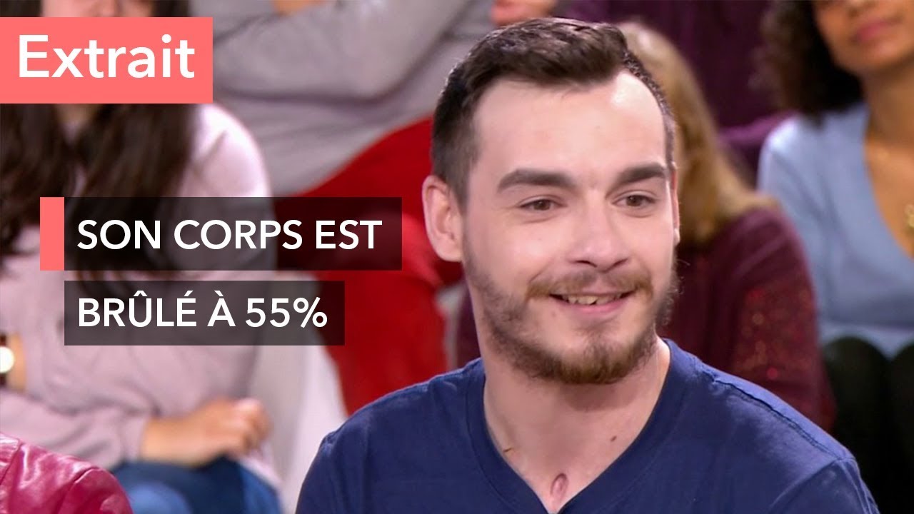 Grand brûlé : il a été enseveli par 7 tonnes de goudron à 150°C - Ça commence aujourd'hui