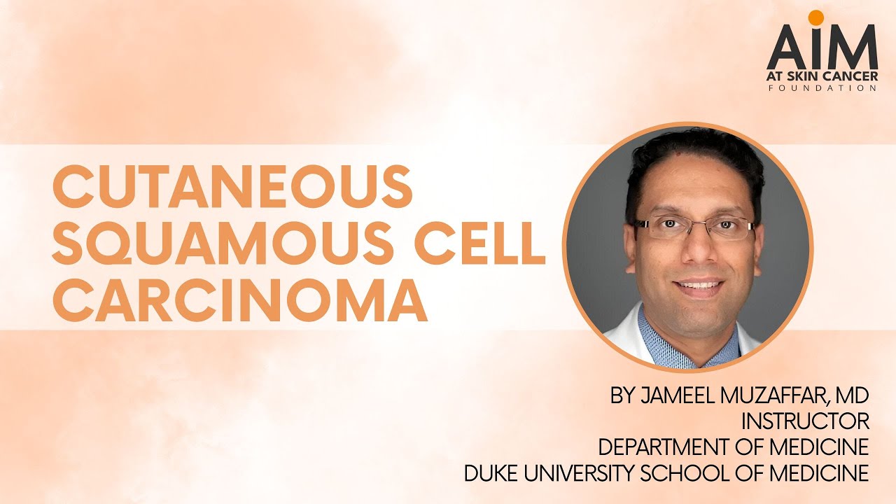 Understanding Cutaneous Squamous Cell Carcinoma