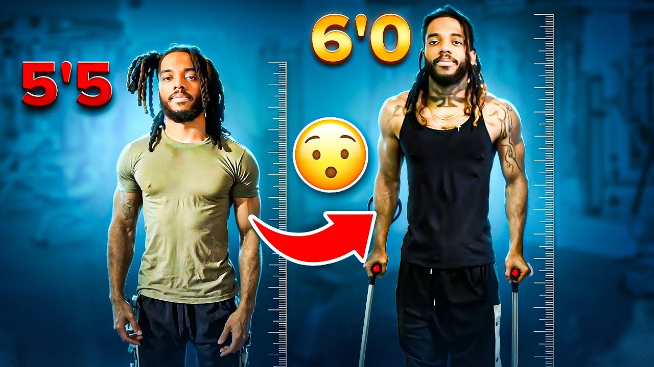 HE GOT SURGERY TO GO FROM 5'5 TO 6'0?!?