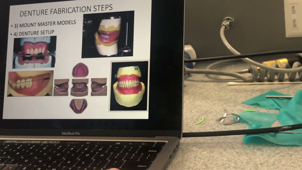 Lab Procedures for Removable Prosthetics - Larry Borgeson, Prosthodontic Engineer, UofU SOD