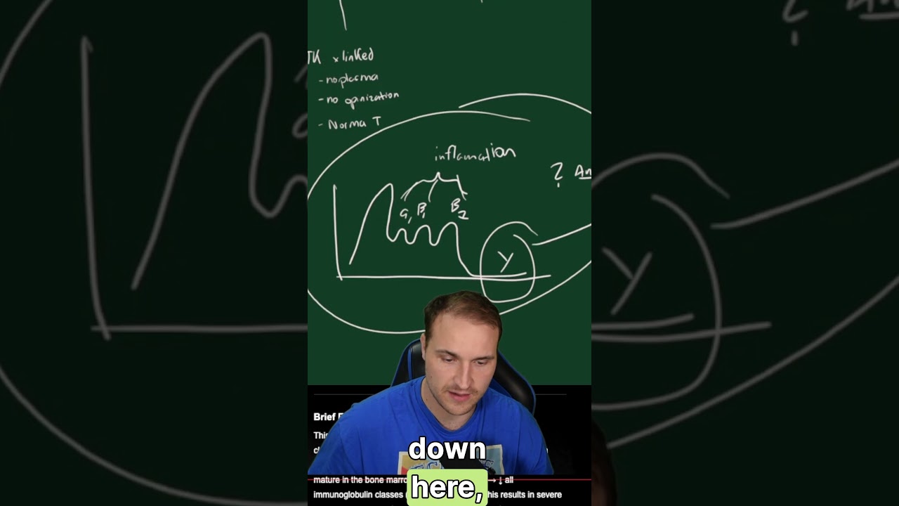 Must-Know this to pass step 1 #step1 #usmle