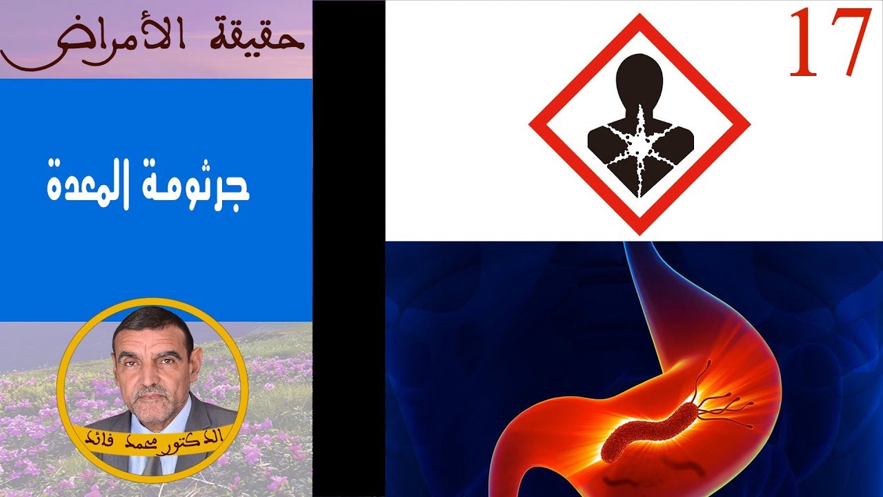 جرثومة المعدة | الدكتور محمد فائد