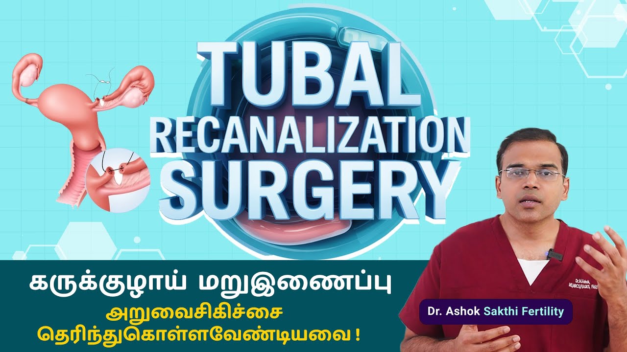 🔥 Tubal Recanalization Surgery: Everything You Need to Know! 🔥