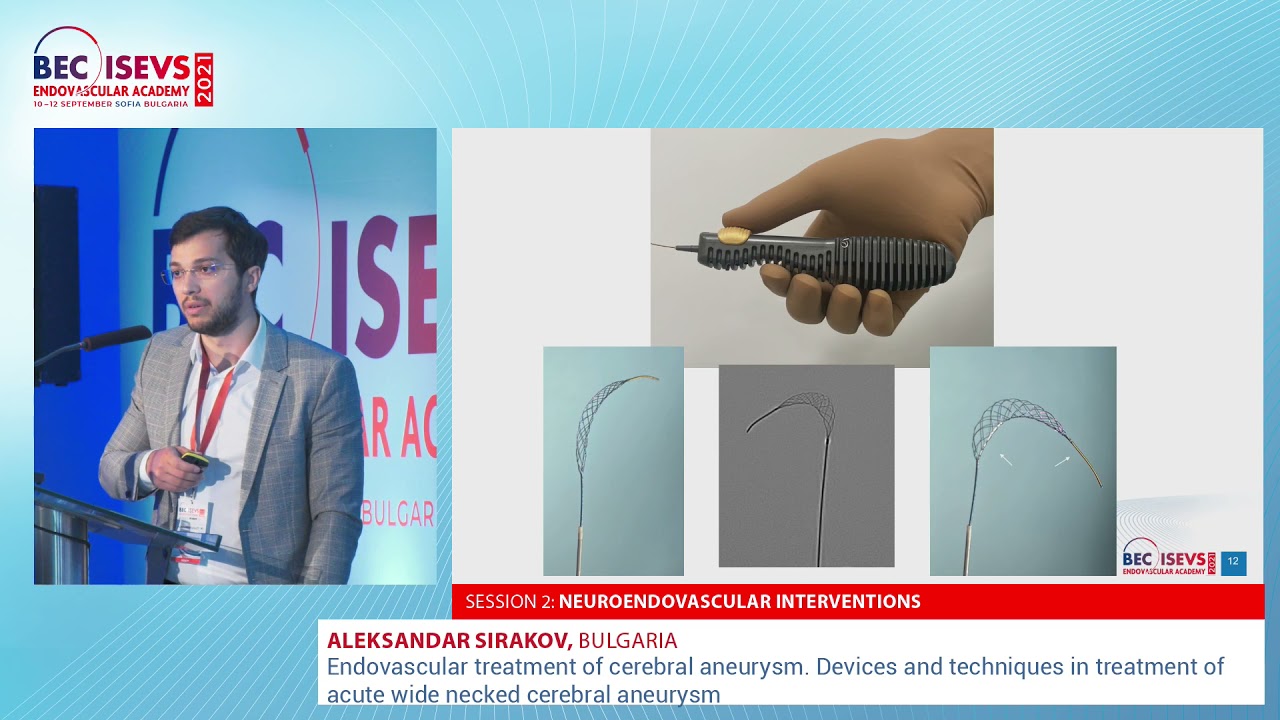 BEC 2021 | Endovascular treatment of cerebral aneurysm | Aleksandar Sirakov