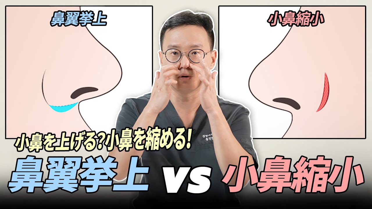 私の小鼻に合った手術はどんな手術？ [鼻翼挙上 vs 小鼻縮小]