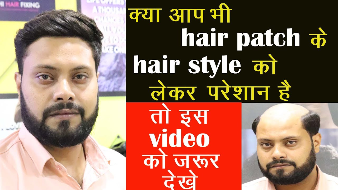 How to Maintain Hair Patch Hair Style? By Abdul Rehman Delhi Hair Fixing. Call Now – 9873152223