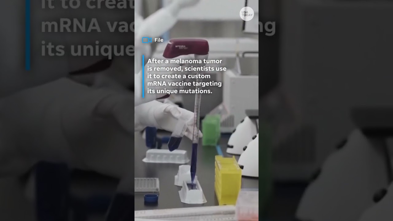 What to know about Moderna and Merck&rsquo;s mRNA melanoma vaccine
