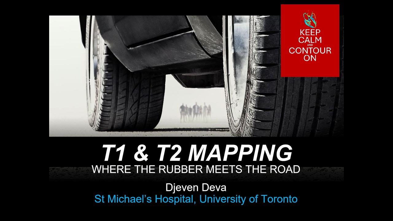 T1 & T2 Mapping Where The Rubber Meets The Road