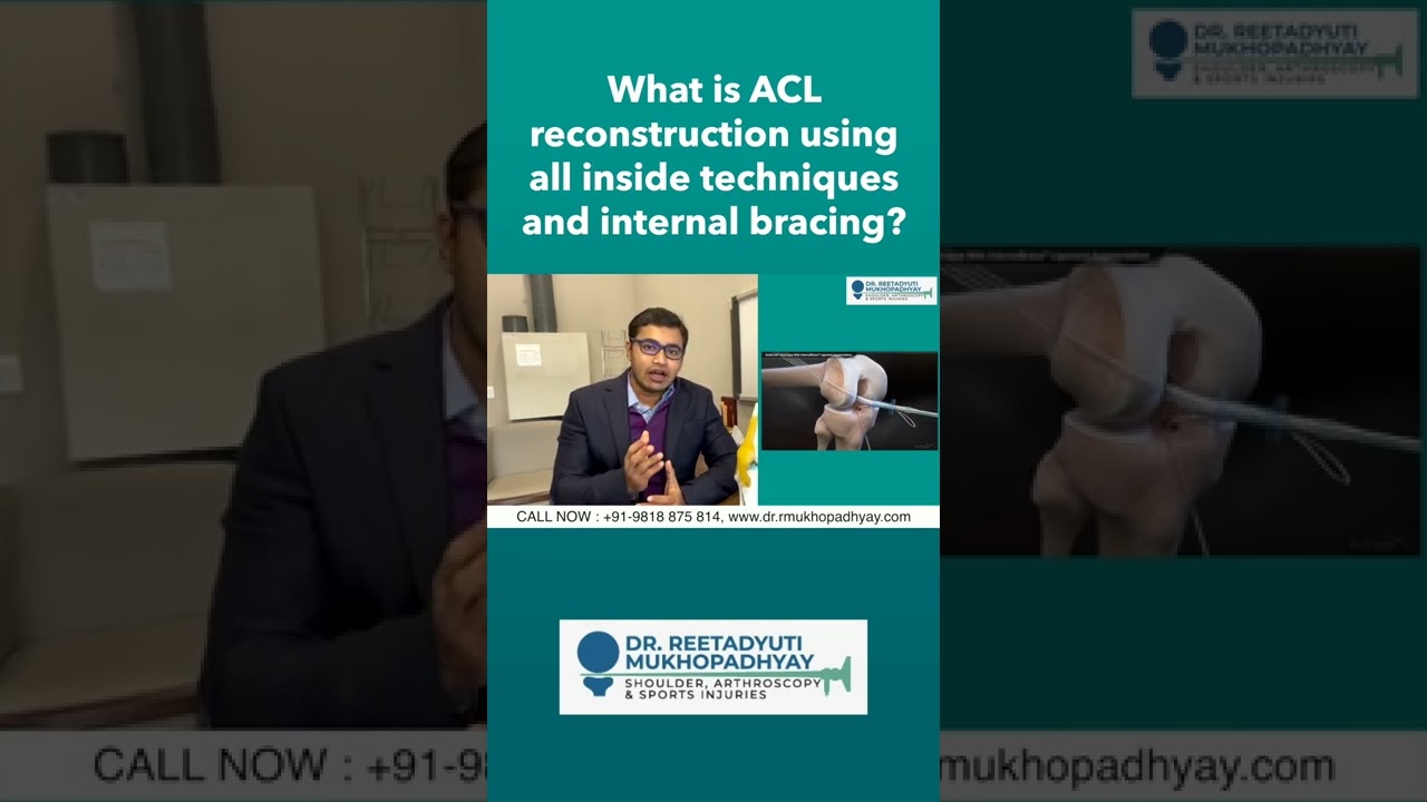 What is ACL reconstruction using all inside techniques and internal bracing?