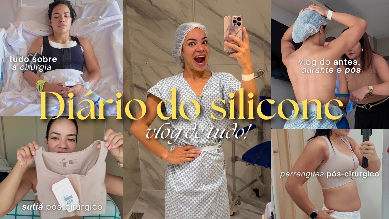 DI&Aacute;RIO DO SILICONE VLOG | Experi&ecirc;ncia completa da cirurgia o antes, durante e p&oacute;s!