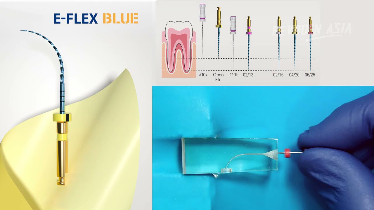 CARA PENGGUNAAN E-FLEX BLUE - ENDO FILE ROTARY - EIGHTEETH - REVODEN ASIA - ENDODONTIK - DOKTER GIGI