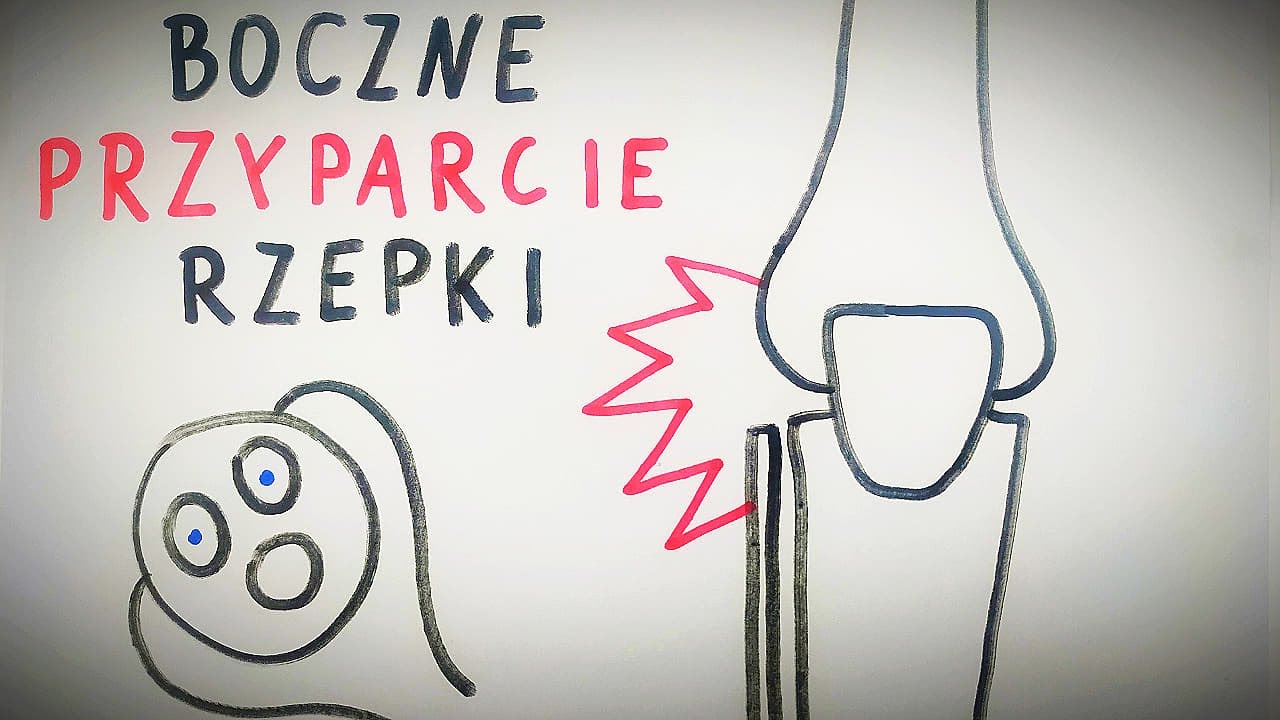 BÓL KOLANA 🔴 boczne przyparcie rzepki 🔴