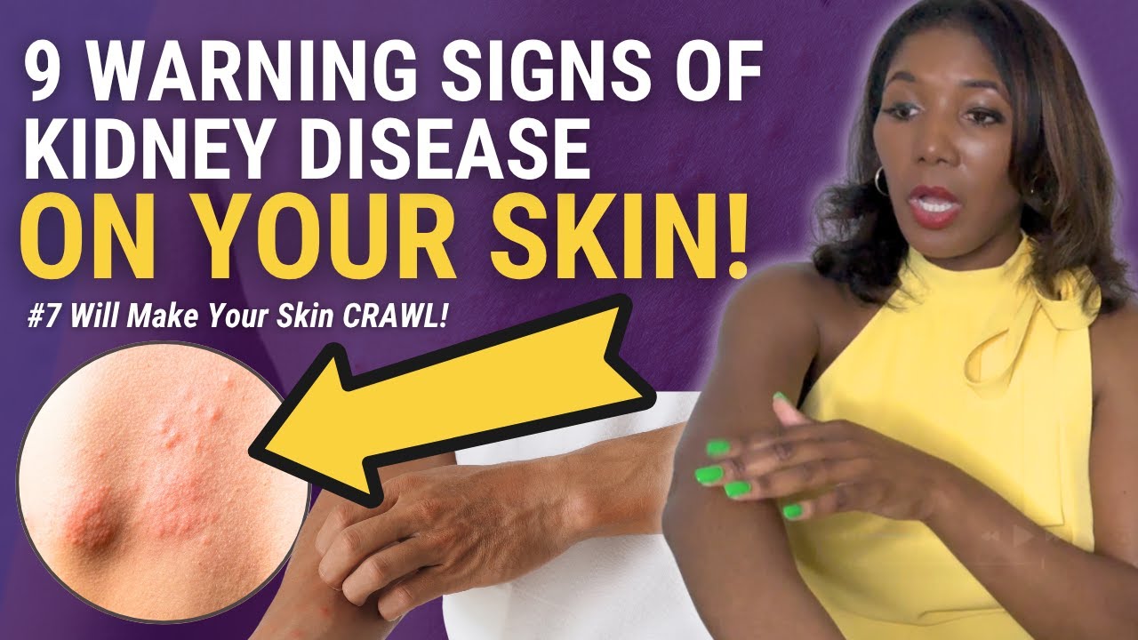 9 Silent Kidney Disease Symptoms Hiding On Your Skin - #7 Has My Skin Crawling