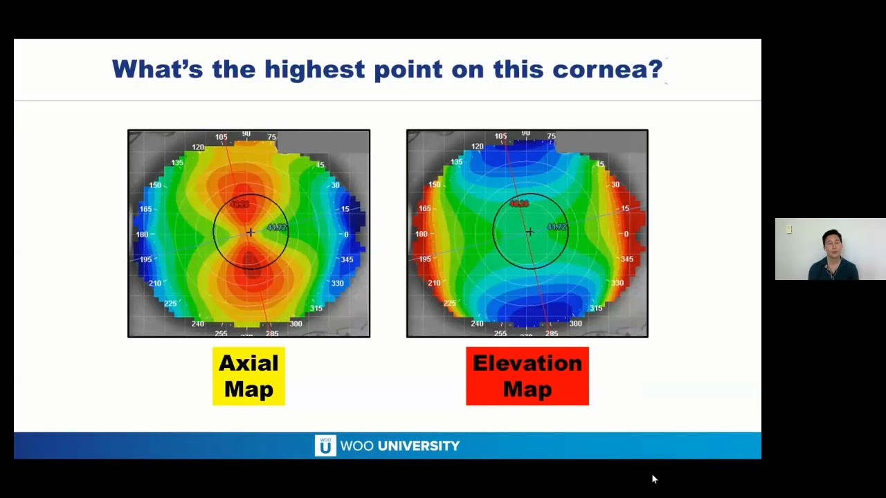 Benefits of Topography