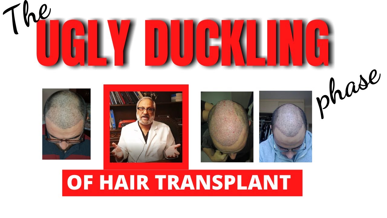 Фаза гадкого утенка