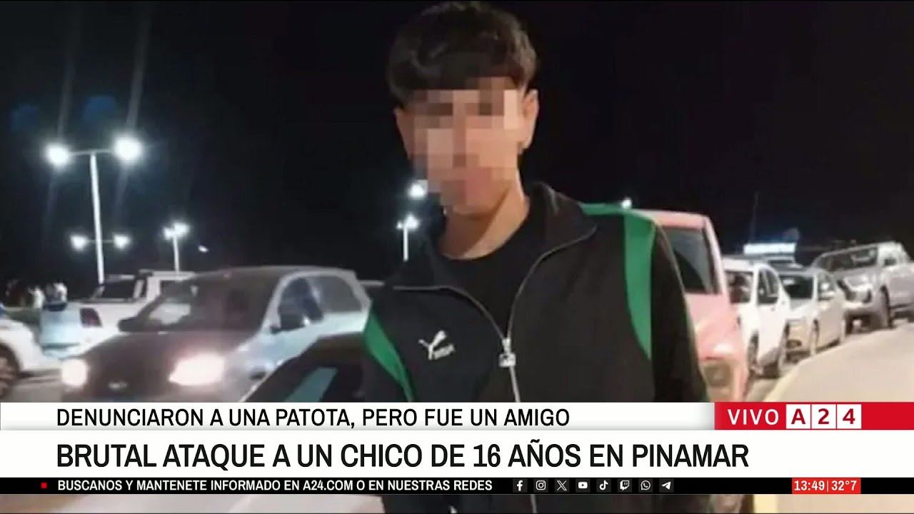 🚨 BRUTAL ATAQUE A UN CHICO DE 16 A&Ntilde;OS EN PINAMAR: THIAGO SUFRI&Oacute; HUNDIMIENTO DE CR&Aacute;NEO