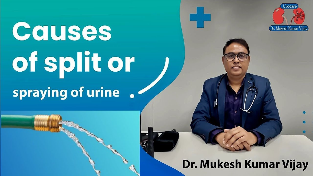 Why your urine sprays everywhere or splits in two