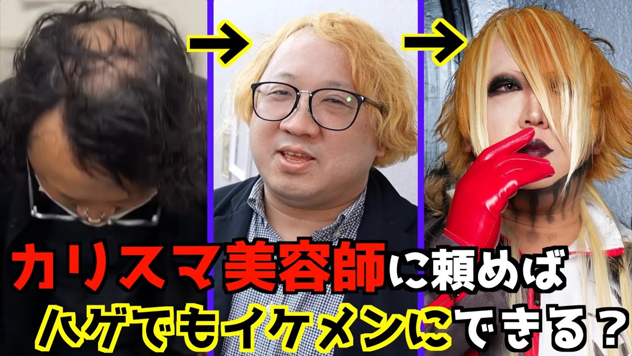 ハゲでもカリスマ美容師に頼めばヴィジュアル系バンドマンにしてくれる？