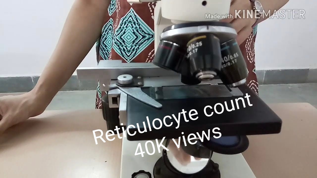 Reticulocyte count