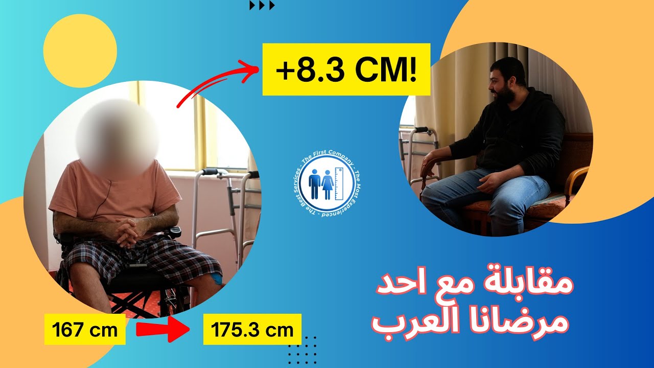مقابلة مع أحد مرضانا من دول العرب: تجاربه عن عملية زيادة الطول . تقنية البريسايس # كويت