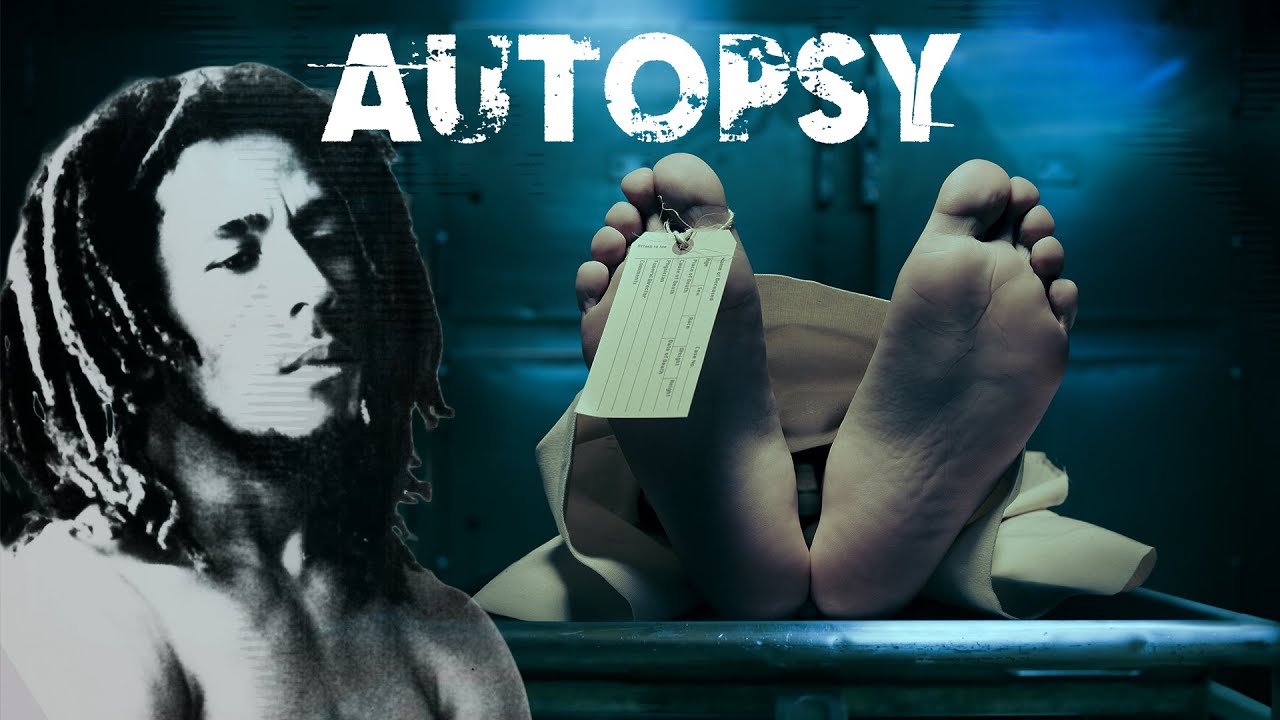 Autopsy Podcast: What Really Happened To Bob Marley?