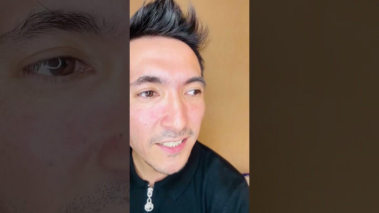 😫 Prank qilishdi. Ko'rmasez bo'midi#massage #news #osteopathy #prank #news #reabitolog #shortvideo 