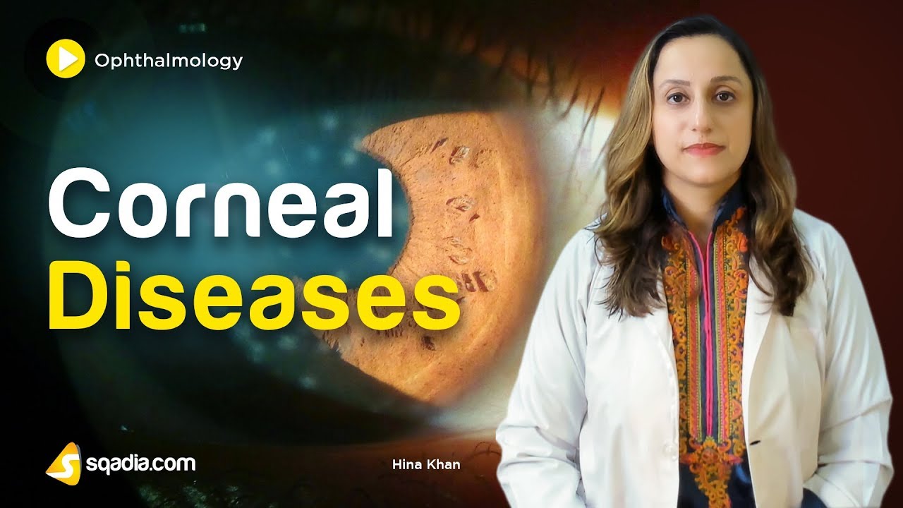 Corneal Diseases | Ophthalmology Online Lecture | Medical Student