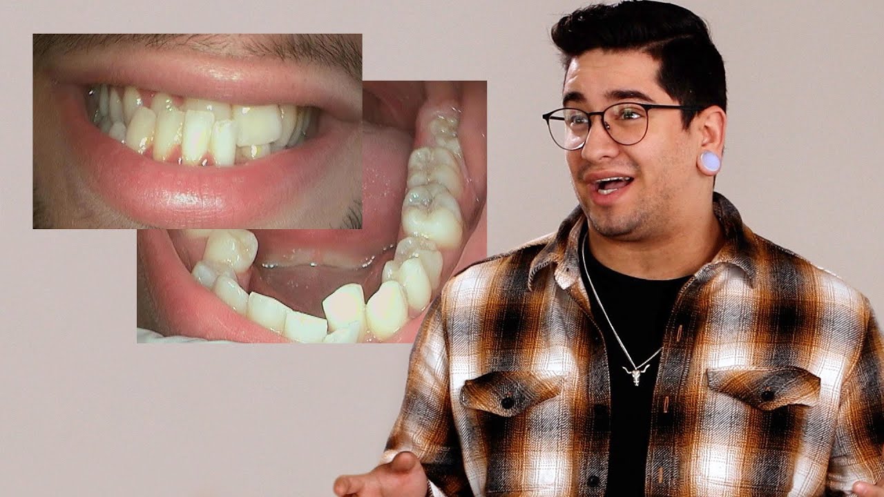 Confidence Is Everything! • Izzy's Smile Story • Adult Braces Before and After